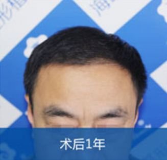 https://img.miyanlife.com/mnt/timg/180517/1339111014-4.jpg