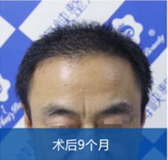 https://img.miyanlife.com/mnt/timg/180517/1339113525-3.jpg