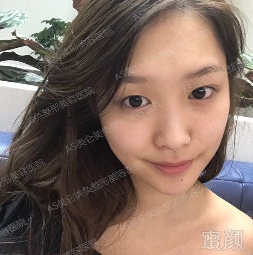 https://img.miyanlife.com/mnt/timg/180517/14042L561-3.jpg