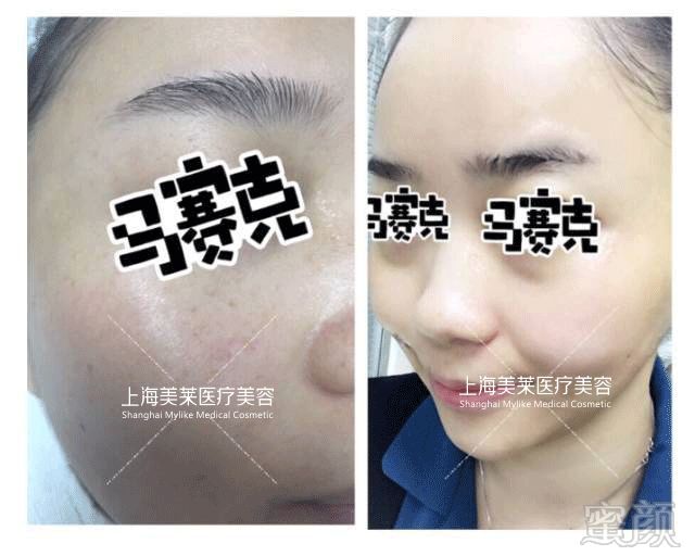 https://img.miyanlife.com/mnt/timg/180518/134230JU-3.jpg