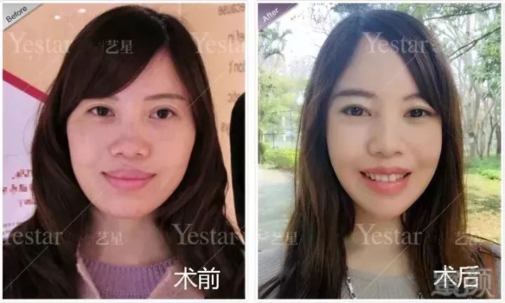 https://img.miyanlife.com/mnt/timg/180518/1344094150-6.jpg