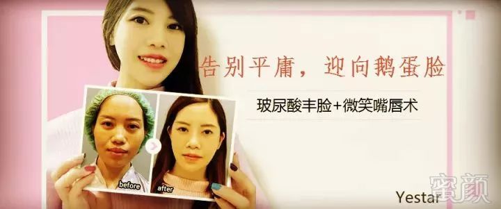 https://img.miyanlife.com/mnt/timg/180518/13440JH6-0.jpg