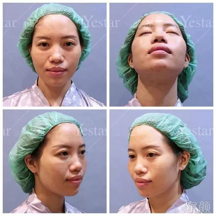 https://img.miyanlife.com/mnt/timg/180518/13440MP0-2.jpg