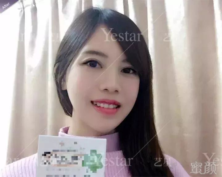 https://img.miyanlife.com/mnt/timg/180518/13440Q449-4.jpg