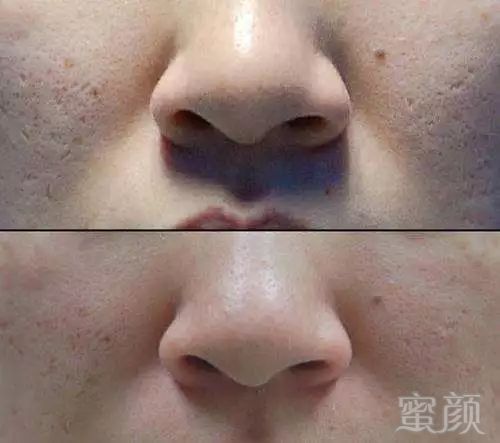 https://img.miyanlife.com/mnt/timg/180518/1426436158-4.jpg