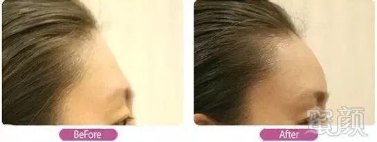 https://img.miyanlife.com/mnt/timg/180518/14341M107-3.jpg