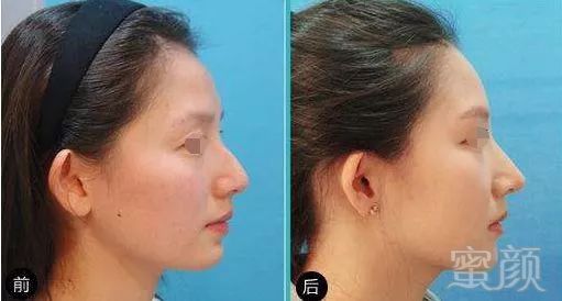 https://img.miyanlife.com/mnt/timg/180518/14341M325-5.jpg