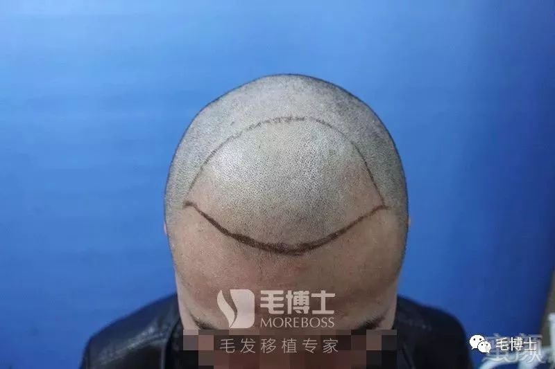 https://img.miyanlife.com/mnt/timg/180518/145S51D0-3.jpg
