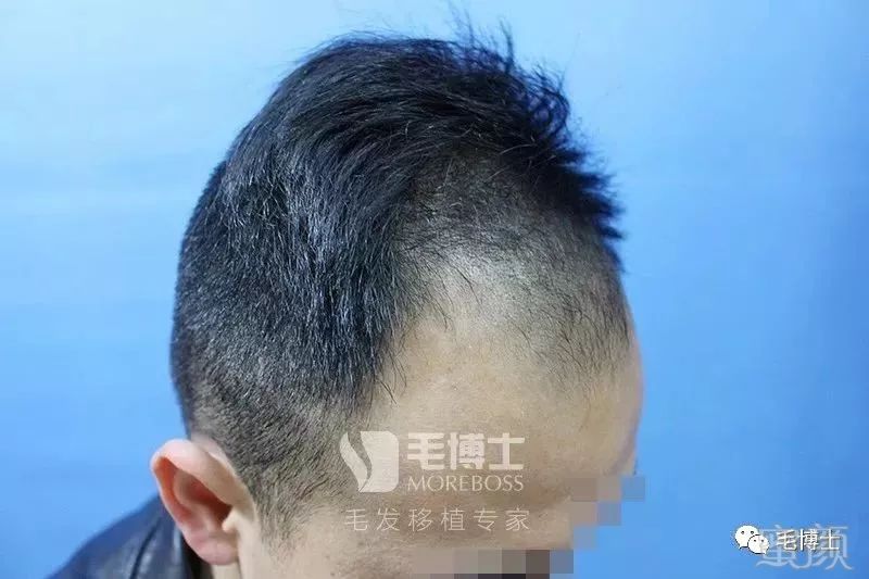 https://img.miyanlife.com/mnt/timg/180518/145S54146-2.jpg