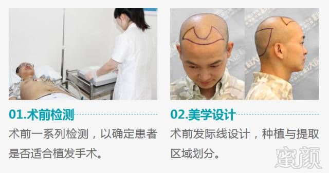 https://img.miyanlife.com/mnt/timg/180518/1503141440-2.jpg
