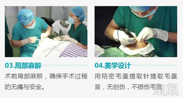 https://img.miyanlife.com/mnt/timg/180518/1503142a2-3.jpg