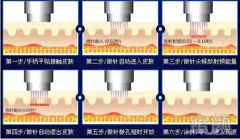 案例图片