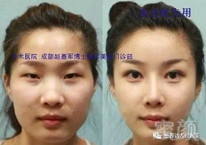 https://img.miyanlife.com/mnt/timg/180518/1541594a2-0.jpg