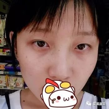 https://img.miyanlife.com/mnt/timg/180518/1551225328-0.jpg