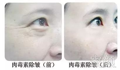 https://img.miyanlife.com/mnt/timg/180519/1056021943-2.jpg