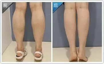 https://img.miyanlife.com/mnt/timg/180519/112609D58-5.jpg