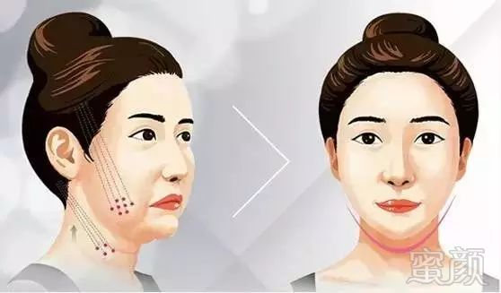 https://img.miyanlife.com/mnt/timg/180519/12104H1Q-6.jpg
