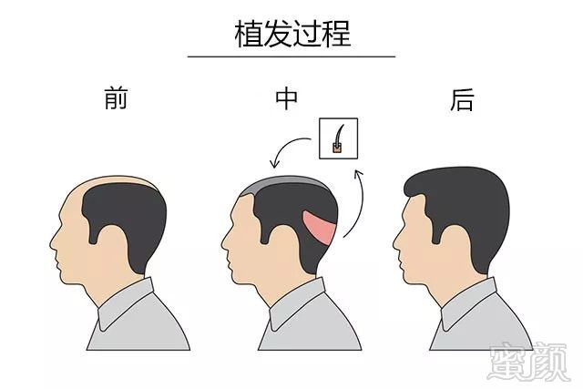 https://img.miyanlife.com/mnt/timg/180519/1221233218-3.jpg