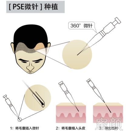 https://img.miyanlife.com/mnt/timg/180519/12212454a-5.jpg