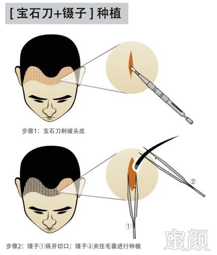 https://img.miyanlife.com/mnt/timg/180519/1221246430-4.jpg