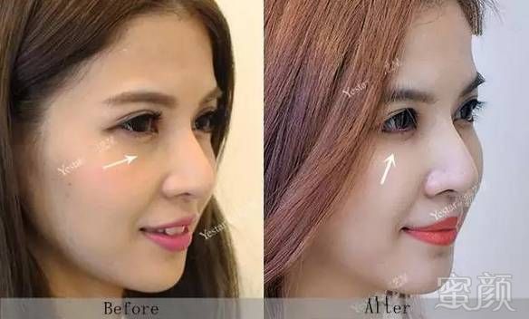 https://img.miyanlife.com/mnt/timg/180519/123HH600-5.jpg