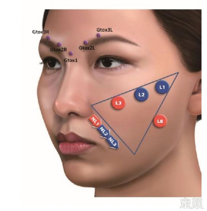 https://img.miyanlife.com/mnt/timg/180519/123ZA629-9.jpg