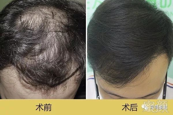 https://img.miyanlife.com/mnt/timg/180519/125419EL-0.jpg