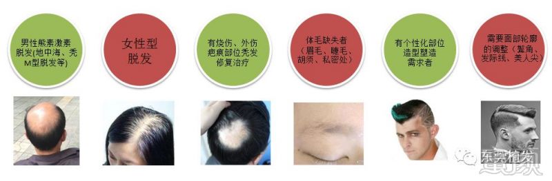 https://img.miyanlife.com/mnt/timg/180519/125421E46-5.jpg