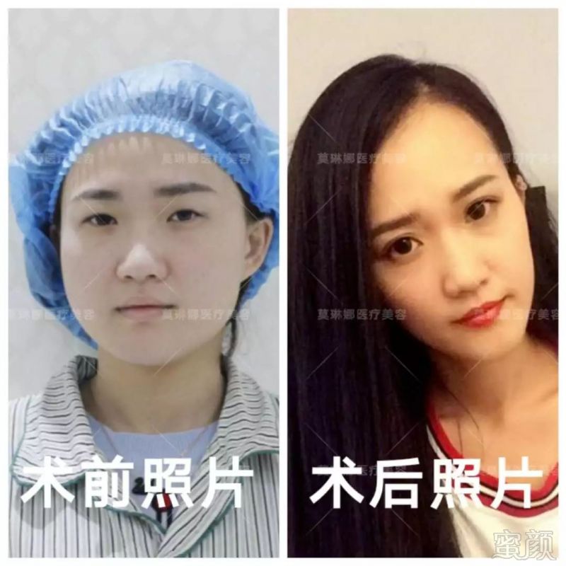 https://img.miyanlife.com/mnt/timg/180520/1123042402-8.jpg