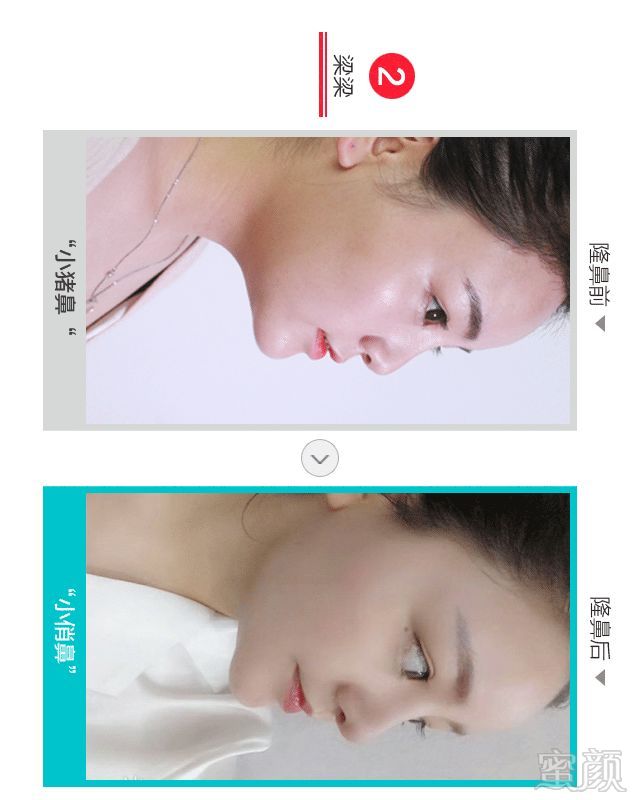 https://img.miyanlife.com/mnt/timg/180520/112GA091-1.jpg