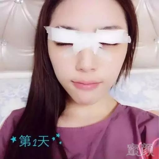 https://img.miyanlife.com/mnt/timg/180520/1134192208-15.jpg