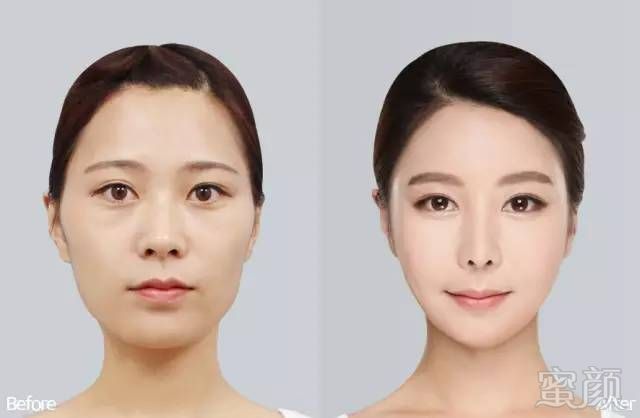 https://img.miyanlife.com/mnt/timg/180520/11341U0T-9.jpg