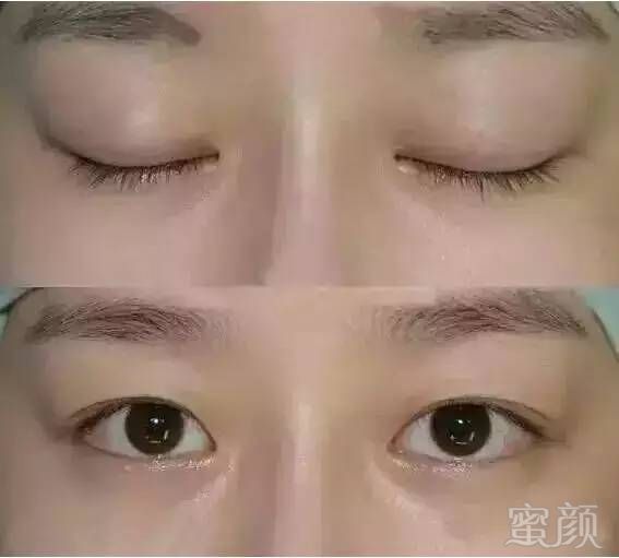 https://img.miyanlife.com/mnt/timg/180520/11341UF2-11.jpg