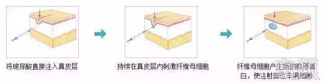 案例图片