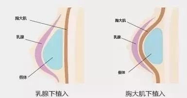 https://img.miyanlife.com/mnt/timg/180520/1214006312-10.jpg 案例图片