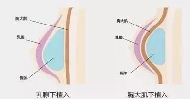 案例图片