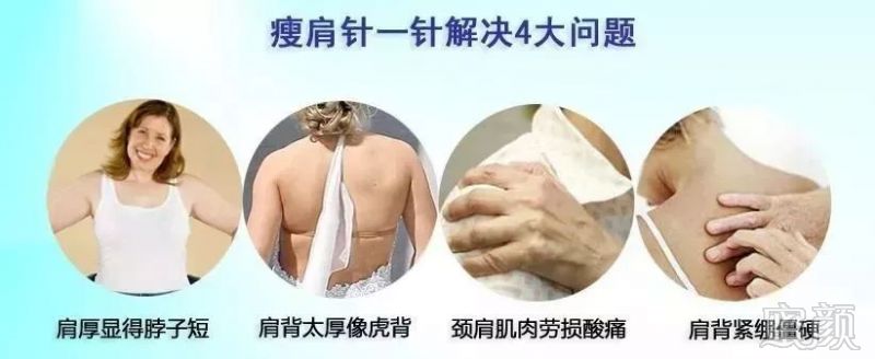 https://img.miyanlife.com/mnt/timg/180520/1216022b3-7.jpg