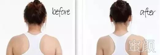https://img.miyanlife.com/mnt/timg/180520/1216022c5-6.jpg