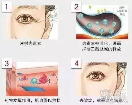 https://img.miyanlife.com/mnt/timg/180521/1101535318-7.jpg