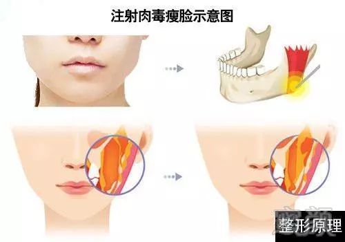 https://img.miyanlife.com/mnt/timg/180521/11015424A-8.jpg