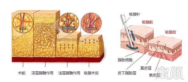 https://img.miyanlife.com/mnt/timg/180521/1101543649-13.jpg