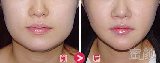 https://img.miyanlife.com/mnt/timg/180521/1101555G1-16.jpg