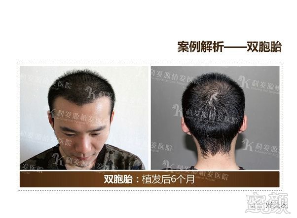 https://img.miyanlife.com/mnt/timg/180521/110225L25-9.jpg