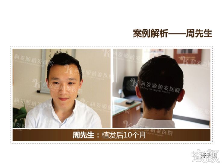 https://img.miyanlife.com/mnt/timg/180521/1102261b7-13.jpg