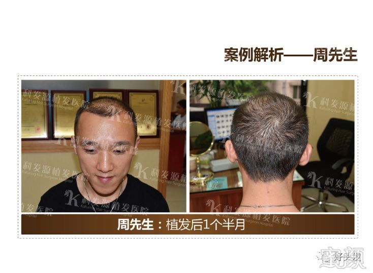 https://img.miyanlife.com/mnt/timg/180521/11022A0Y-12.jpg