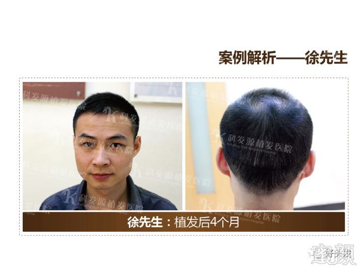 https://img.miyanlife.com/mnt/timg/180521/11022B459-11.jpg