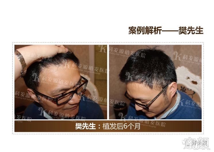 https://img.miyanlife.com/mnt/timg/180521/11022G950-15.jpg