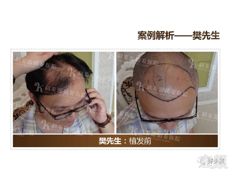 https://img.miyanlife.com/mnt/timg/180521/11022K443-14.jpg