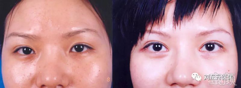 https://img.miyanlife.com/mnt/timg/180521/1103093507-2.jpg