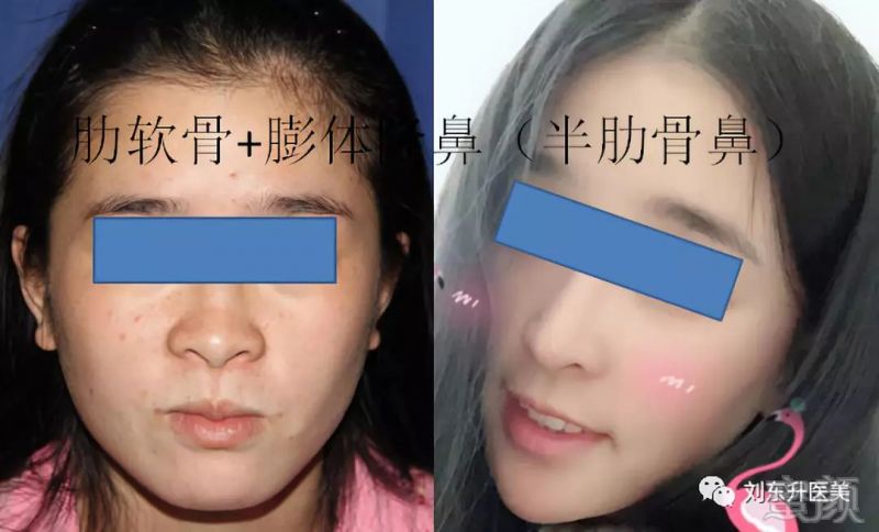 https://img.miyanlife.com/mnt/timg/180521/1103103235-5.jpg